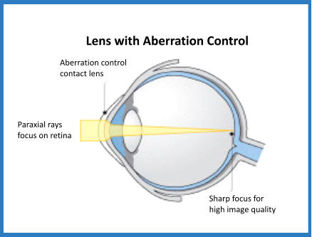 Lens with Aberration Control Aberration control  contact lens Paraxial rays focus on retina Sharp focus for high image quality